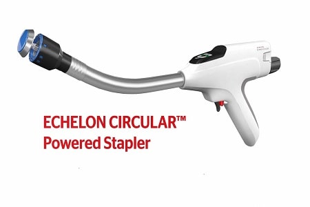 Product Review Ethicon ECHELON CIRCULAR Powered Surgical Stapler - TechSci Research